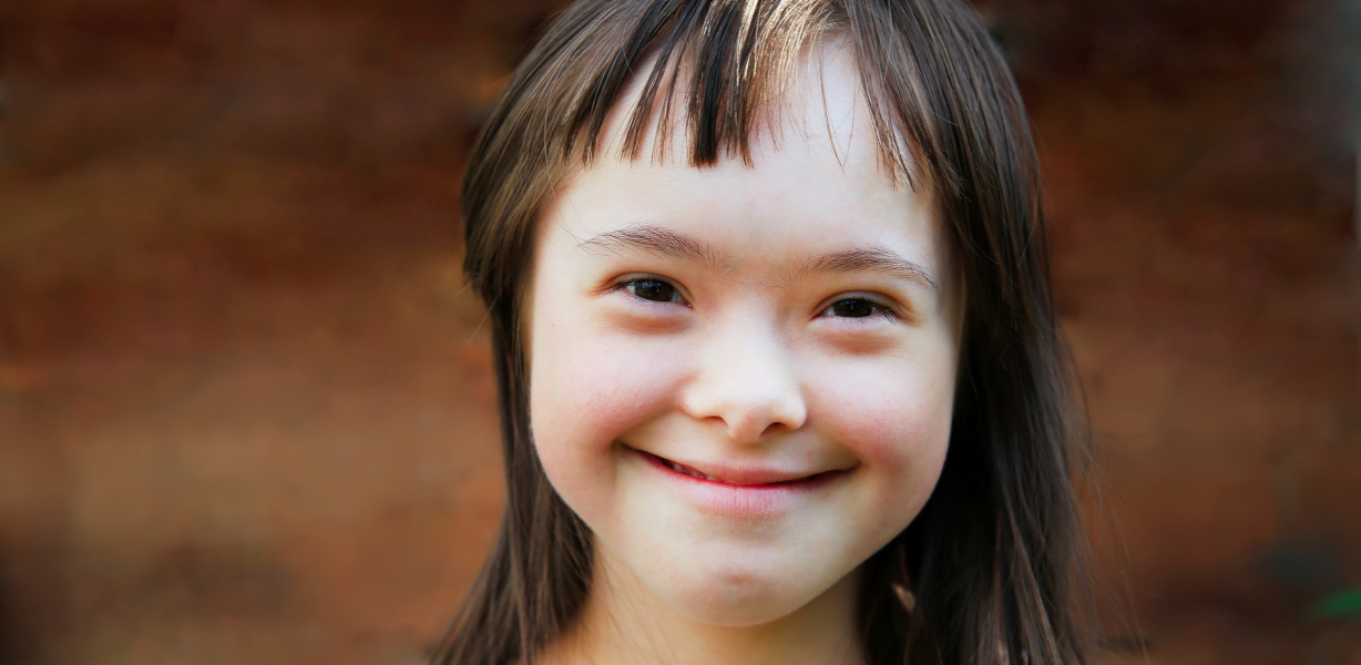 A happy girl with Down Syndrome smiling A happy girl with Down Syndrome smiling