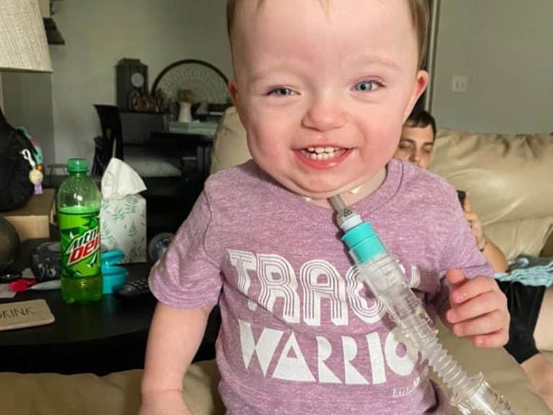 Child with Tracheostomy tube